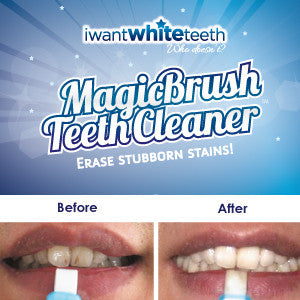 MAGIC BRUSH TEETH CLEANER